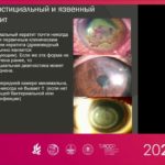 Общие вопросы офтальмологии