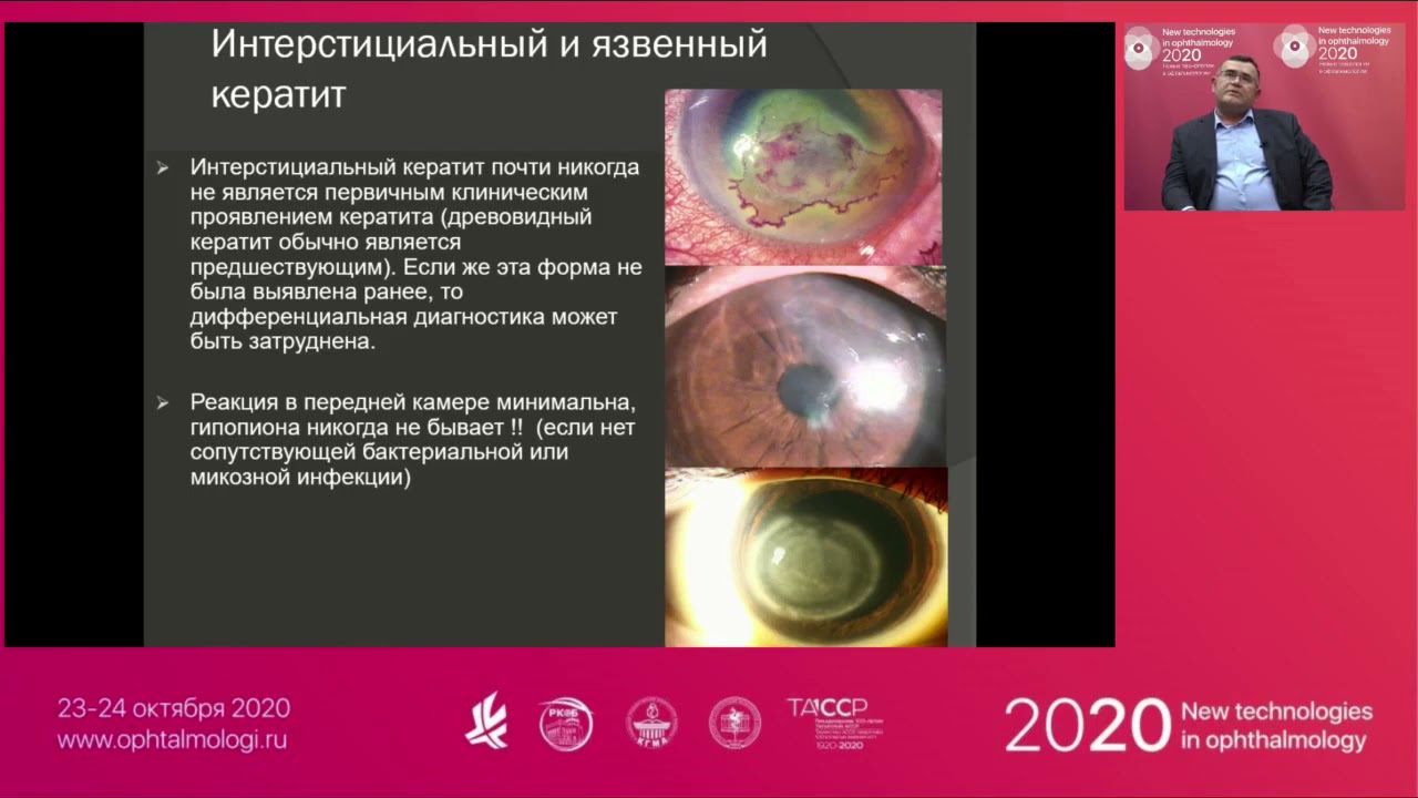 Общие вопросы офтальмологии