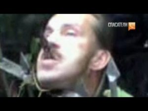 Проткнул голову об ограду