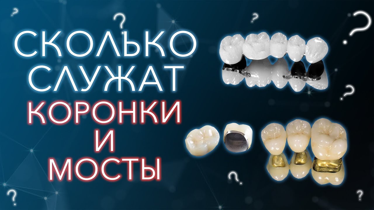 Сколько служат коронки и мосты. Главный миф.